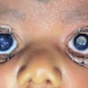 Meet your Posher, Blink